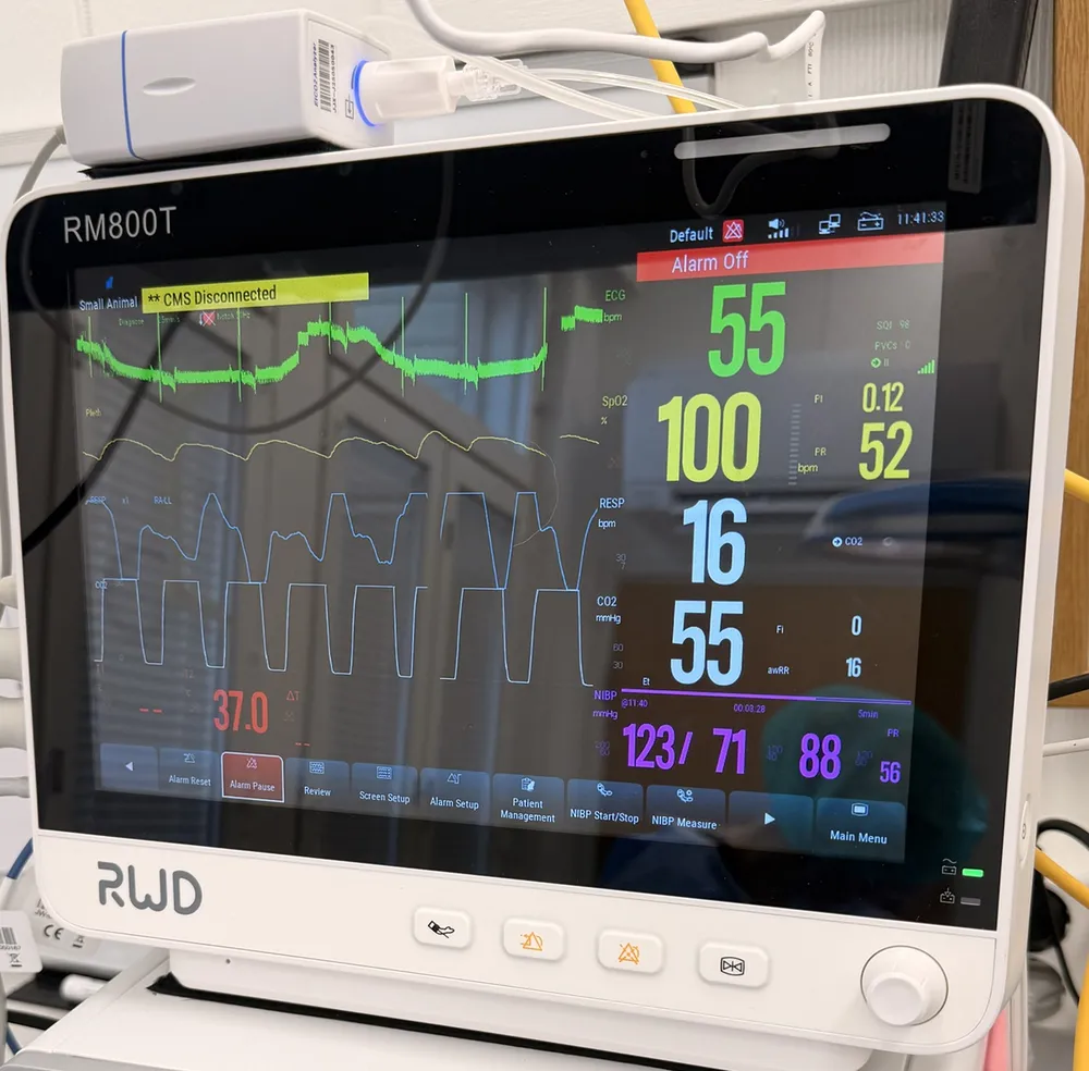 Anestesiamonitorin näyttö, jossa näkyvät EKG-käyrä, happikyllästeisyys, kapnografiakäyrä, ruumiinlämpö ja verenpaine; monitorin päällä hiilidioksidianalysaattori