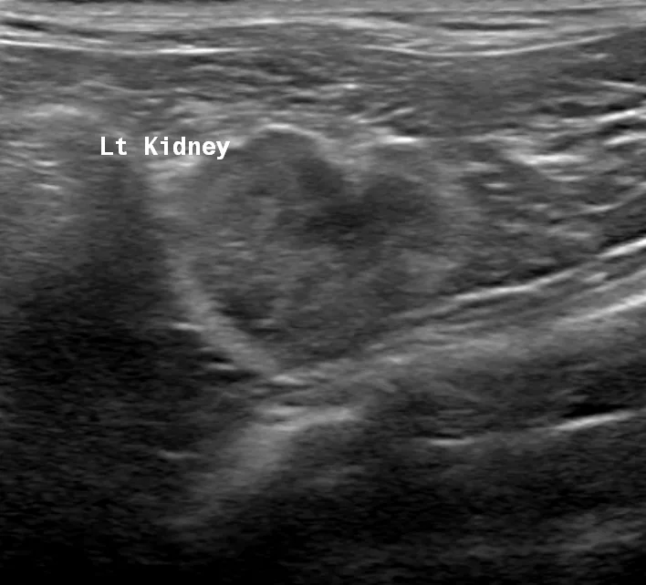 Ultrasound image of the left kidney of a cat with chronic kidney disease