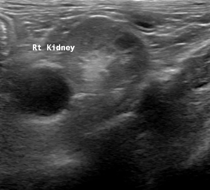 Ultrasound image of a cat’s right kidney: a cyst shows as a dark, round area