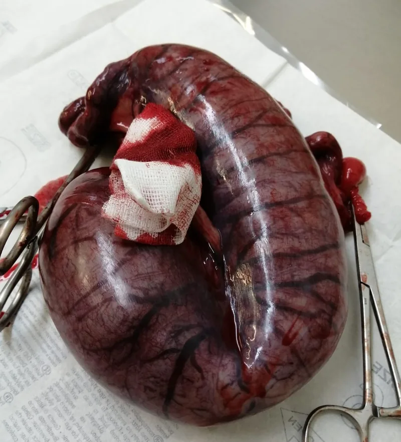 Bortopererad livmoder från en hund med pyometra, utspänd av var